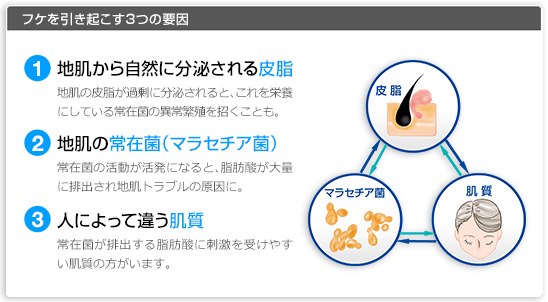 フケの原因って?Dr.AGAクリニックが教えます!