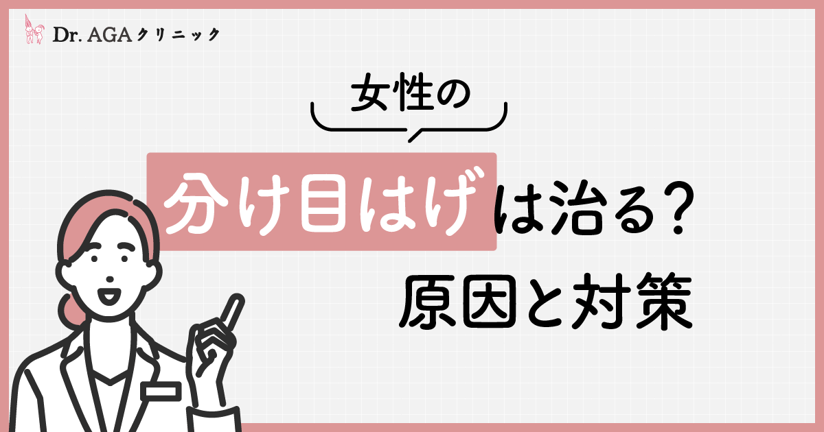 女性の分け目はげは治る？原因と対策を紹介