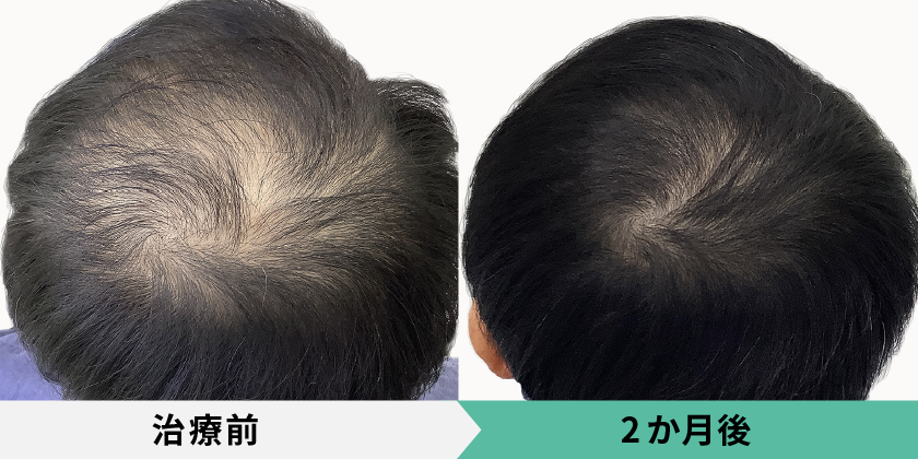 症例写真